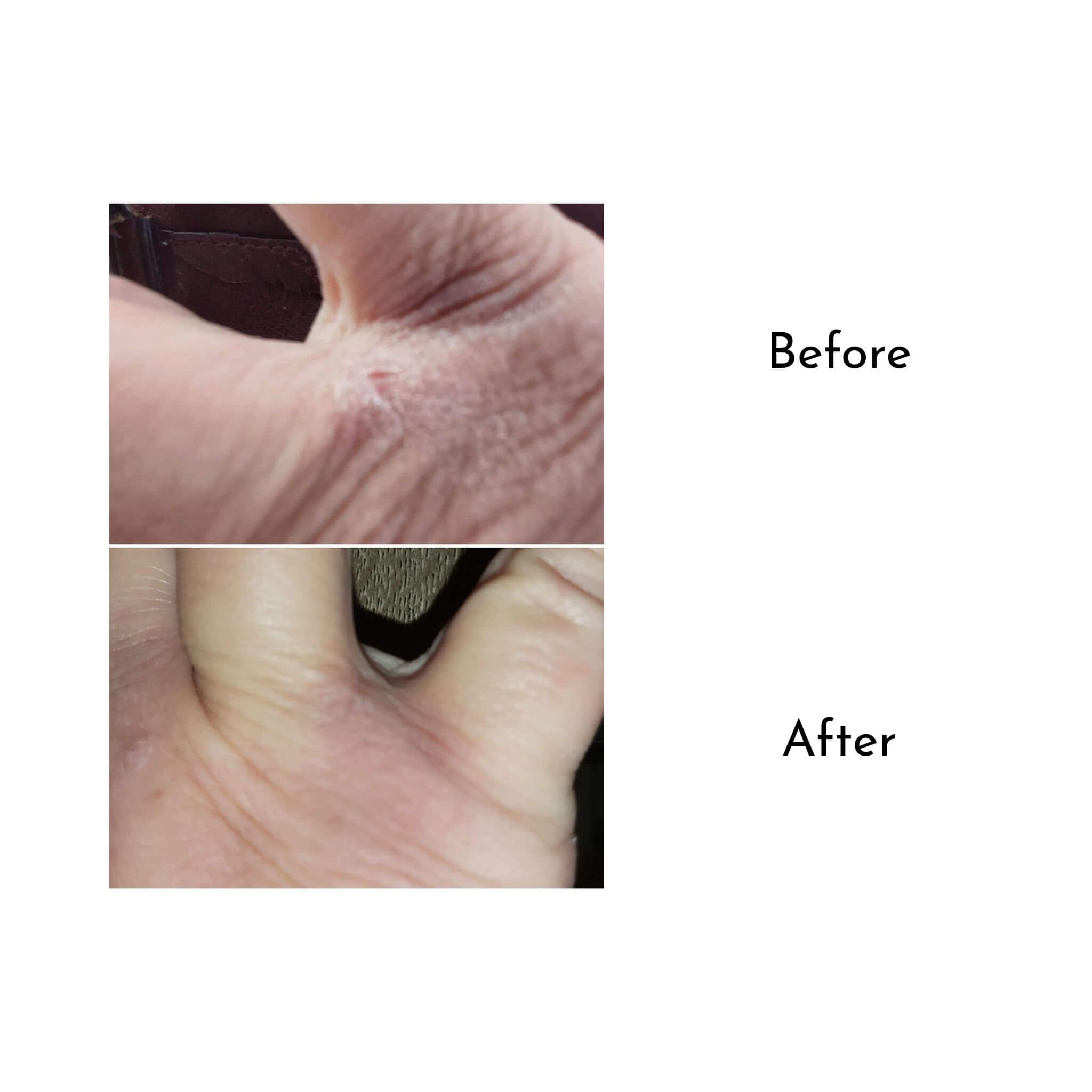 Blossom & Hive honey butter balm before and after photo showing cracked skin between fingers and then a second photo showing the skin healed