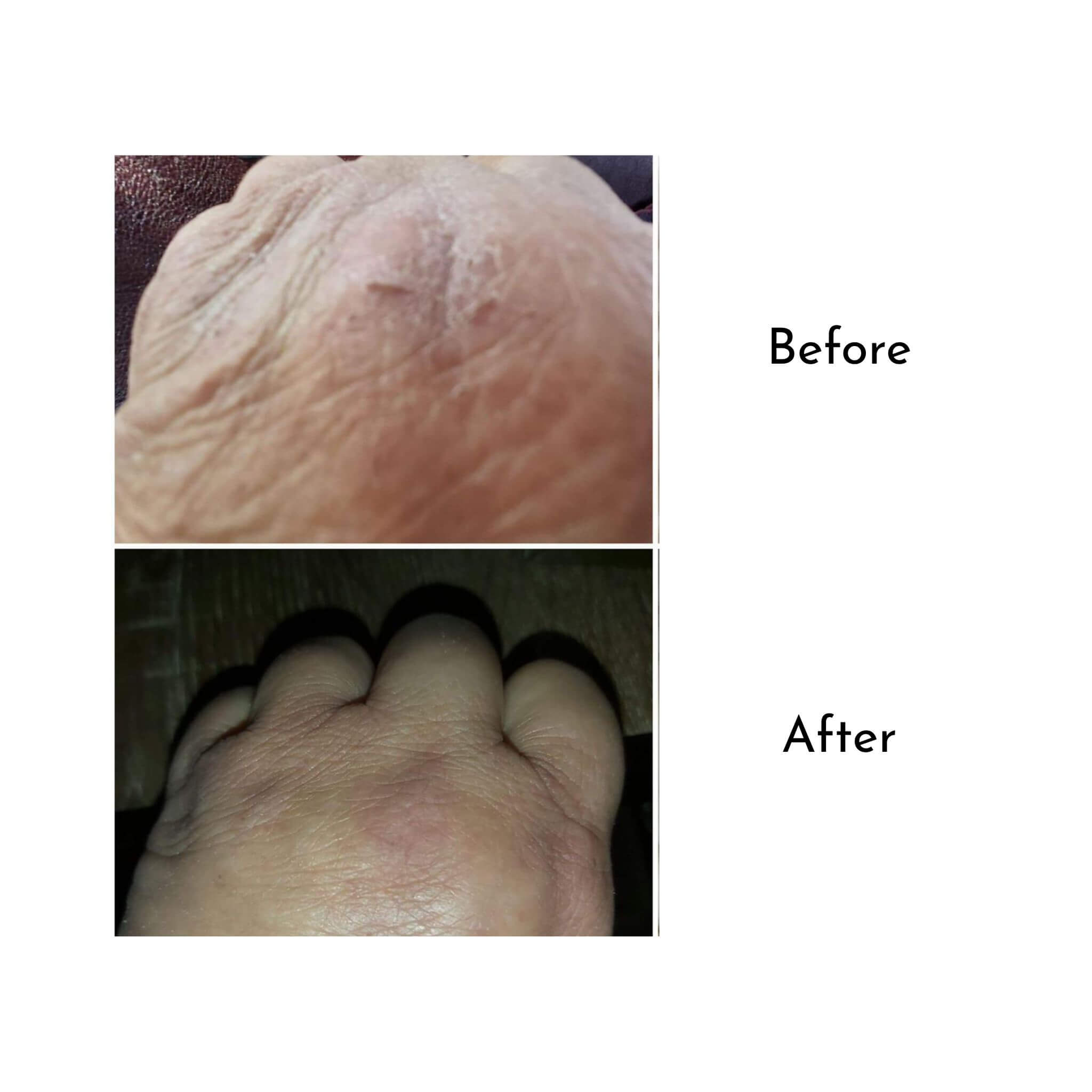 Blossom and Hive Honey Butter Balm before and after photos showing dry chapped skin healed after using Honey Butter Balm